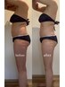 五十嵐担当【美腸整】腸セラピー×全身オイルマッサージ120min￥14000→12000