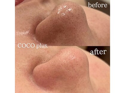 ココプラス(COCO plus.)の写真