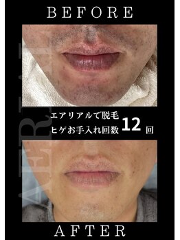 エアリアル 中津店/写真を見てご本人もビックリ!