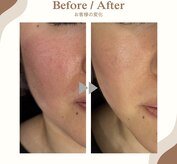 ラヴィ コロレ(La vie colore)