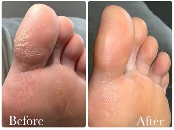 リゼラアンドコー 盛岡店/ドイツ式フットケア専門店