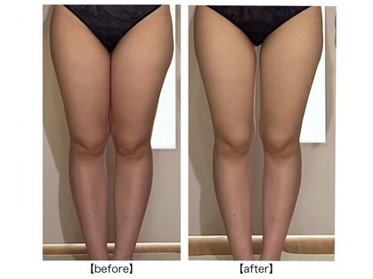 パルティール 恵比寿店(partir)の写真