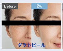 ビオトナス(Facial Esthe)