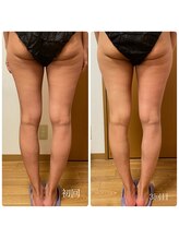 ムム(MooMoo)/脚裏～ヒップ　3回目