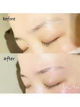 クレー(Klee)/アイブロウリフト