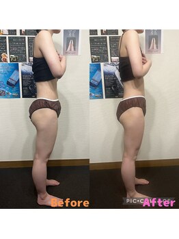 アルメリ 恵比寿(Almeri)/硬くなりやすい下半身もスッキリ