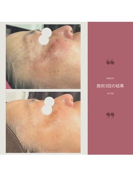 サロンド ビューティ ル マール(Le mar)/シミシワ改善、潤い溢れる素肌へ