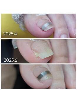 爪切り屋 足楽/