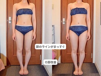 ピュアノア 垂水店/痩身人気No.2【骨格・姿勢矯正】