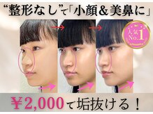 ラプリ 大宮店(Raplit)/隆鼻＋輪郭矯正40分30回