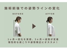 ストレッチリヴェラ(STRETCH LIVERA)の雰囲気（施術前後での可動域の変化【茗荷谷/文京区/後楽園/新大塚】）