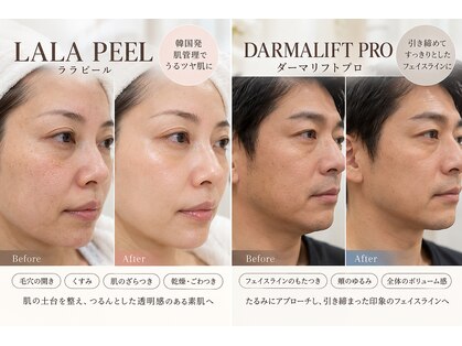 Total beauty salon SOIA【ソワエ】横浜天王町/毛穴・小顔・痩身・リンパマッサージの写真