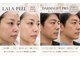 Total beauty salon SOIA【ソワエ】横浜天王町/毛穴・小顔・痩身・リンパマッサージの写真