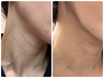 ベルドア(Bell Door)/首のエイジングケア