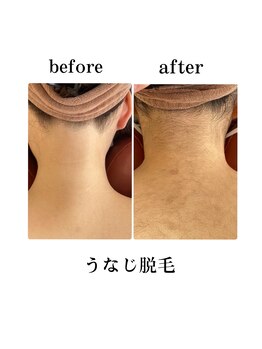 エステティックレイビス 弘前店(RAYVIS)/