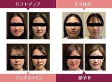 ラクア