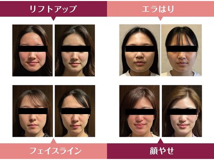 ラクアの写真