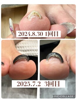 ブロックファイブハナ(Block 5 HANA)/