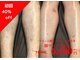 メンズ エステティック ヒーロー(men's esthetic HERO)の写真