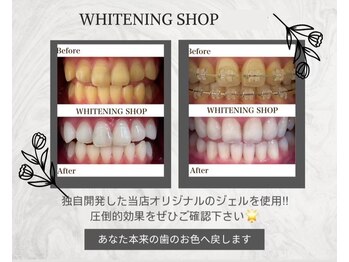 ホワイトニングショップ 広面店/ビフォーアフターで一目瞭然☆
