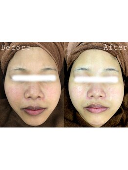 オアシス 一宮(Oasis)/しみ・くすみケア!透明感UP!