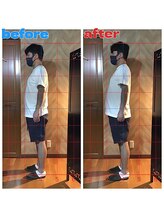 春日部コアラ整体院/Before→After(姿勢)横向き