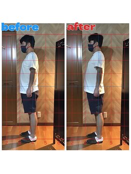 春日部コアラ整体院/Before→After(姿勢)横向き