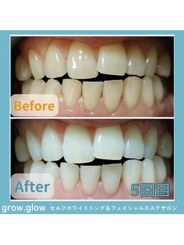 グロウ グロウ(grow.glow)/