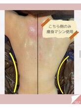 リラベル(Lira Belle)/左右バランスが気になる方にも