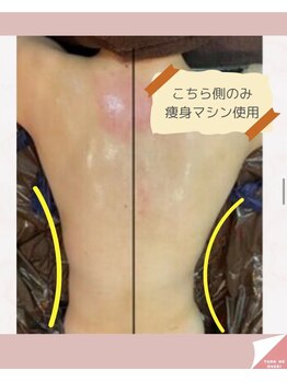 リラベル(Lira Belle)/左右バランスが気になる方にも