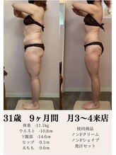 ポノ 甲府本店(pono)/筋膜リリース