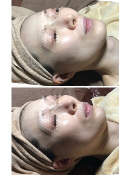 リアン(凛晏)/ビフォーアフター