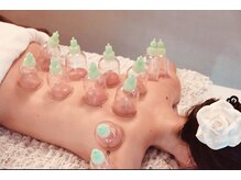 エステプリヴェモロッコ(ESTHE PRIVE MOROCCO)の雰囲気（【カッピング】コリ改善、慢性疲労、蓄積された疲労に◎[肩こり]）