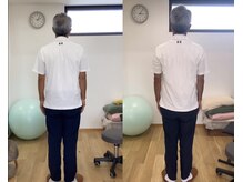 ランドル(rendre)/70代男性、物を担いで腰痛