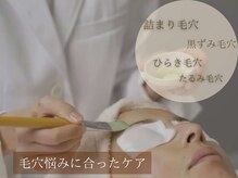 ブレス(Breath)の雰囲気（お悩みに合わせたケアをご提案）