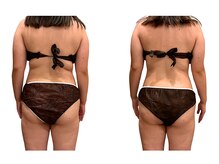 アイル(Isle)/痩身エステコース3回