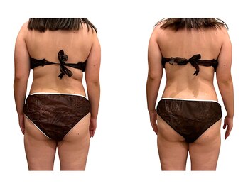 アイル(Isle)/痩身エステコース3回