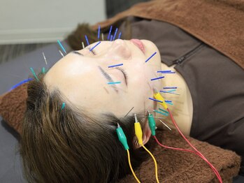 リベルタ鍼灸整骨院 新宿院(Liberta鍼灸整骨院)/化粧ノリが変わる！美肌美容鍼