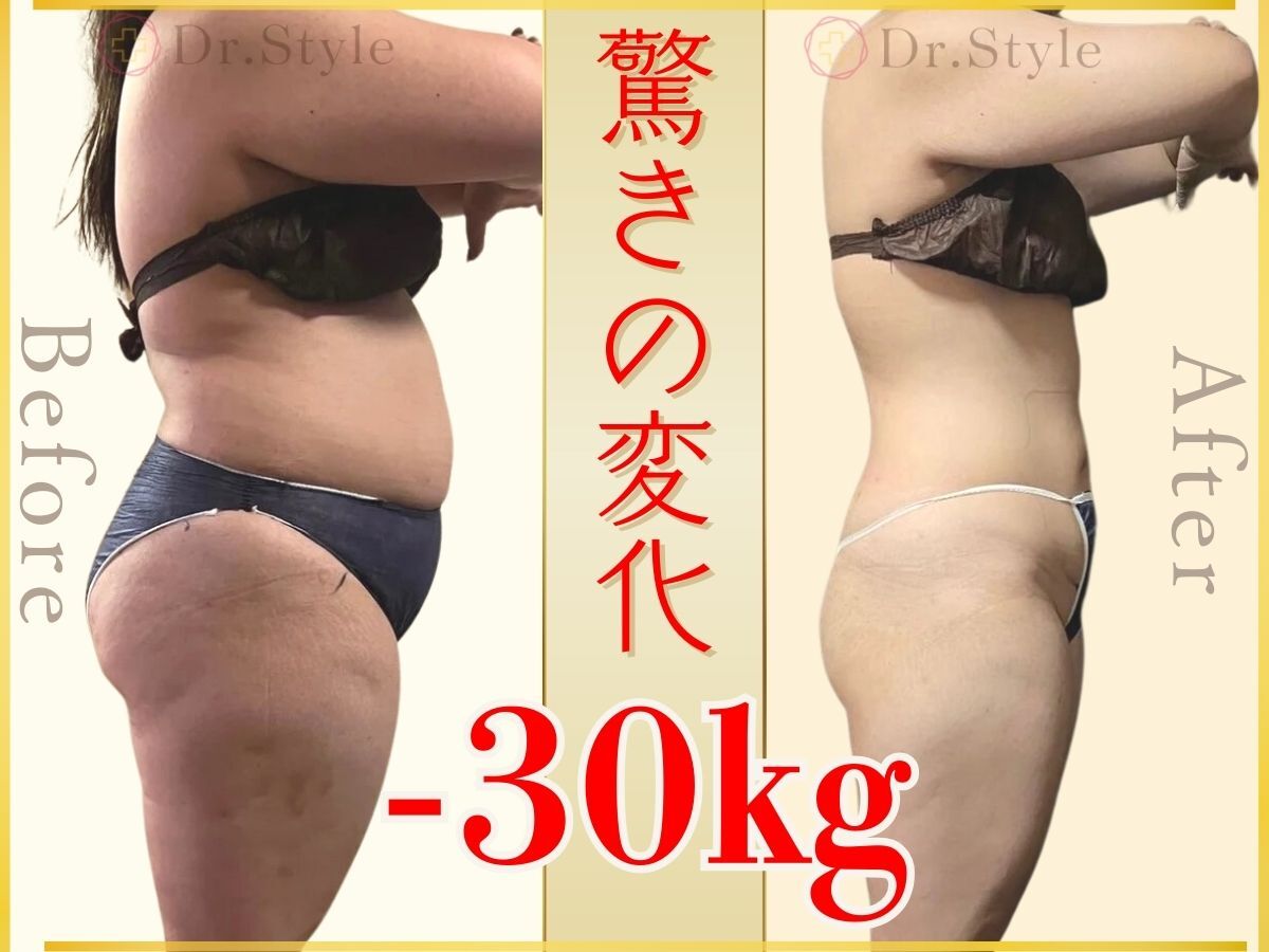 痩身エステ 美容整体 ドクタースタイル(Dr.Style)｜ホットペッパー