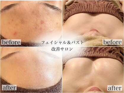 ナトゥーラ チュチュ(natura chuchu)の写真