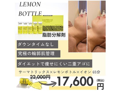 ラピス 新宿の写真