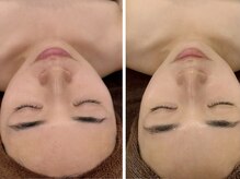 イディアル(IDE'AL)の雰囲気(【毛穴・赤み・ニキビ・シミ・シワ・たるみ】の改善へ◎ピール*)