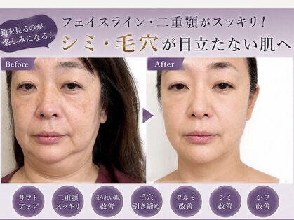 ミルジュ(MiLuJu)の写真