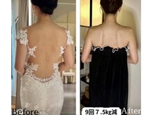 蒼(so)の雰囲気(秋冬・11~2月婚の花嫁様多数。出ない鎖骨&肩甲骨はここで即解決)