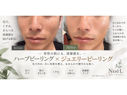 ノエル(NoeL)の写真