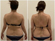 TMサロン 赤坂/【背肉+わき肉】撃退！