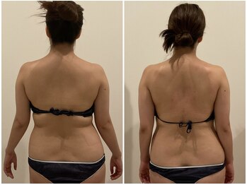 TMサロン 赤坂/【背肉+わき肉】撃退！