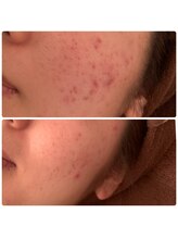 ジョルジオ東京/2Bバイオビューティー