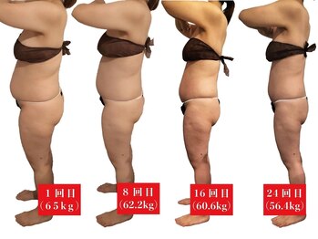 アマンシィ(Amincir)/【Before/After】エンダモロジー