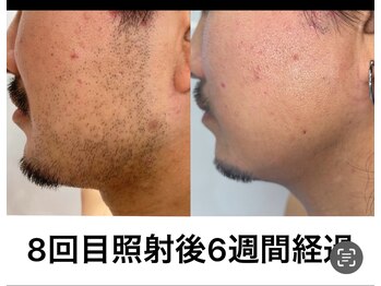 ルイース(LOUISE.)/